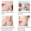 72/180pcs Hydrocolloid Acne Patch Waterproof Acne Removing PU Film Face Printing Spots Marks Invisible Acne Cleansing Patch