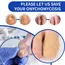 Nail Repair Patches Toenail Fungus Patch Sticky Toenail Care Nail Ingrown Correction Sticker Paronychia Disposable Toe Patch