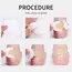 10-100pcs Gel Heel Protection Foot Patches Adhesive Blister Pads Hydrocolloid Heel Liner Shoes Stickers Pain Plaster Foot Care