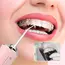 USB Portable Oral Irrigator Water Flosser Dental Water Jet Tools Pick Cleaning Teeth 200ML 4 Nozzles Mouth Oral Cleaning Agents